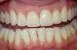 Los Angeles Cosmetic Dentist